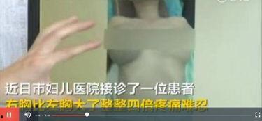 注射丰胸视频,视频解析与专业解读